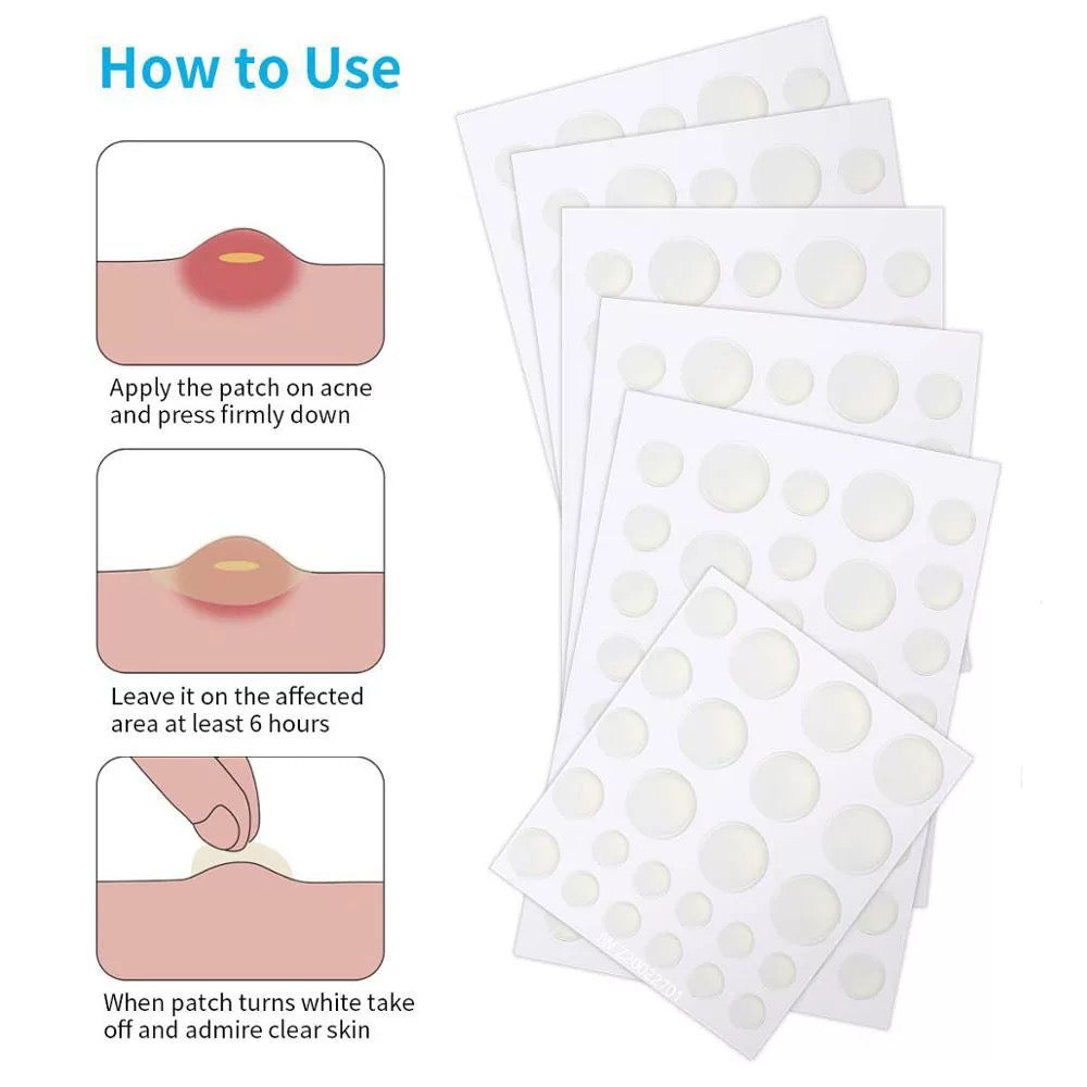 Acne Patches
