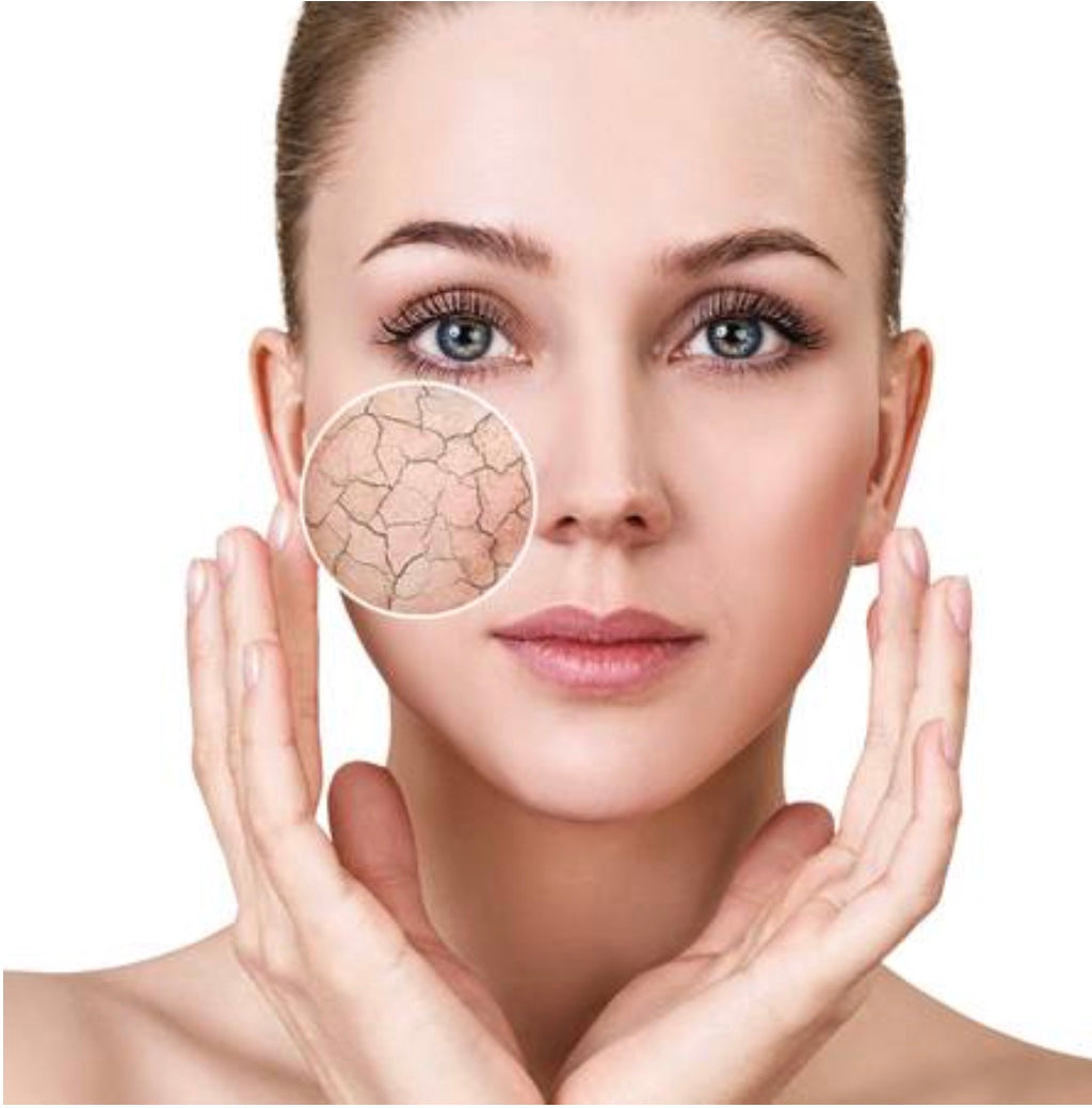 Dry Skin?